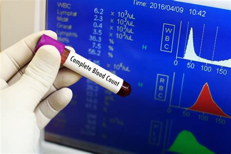 Complete Blood Picture Test Preparation