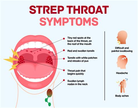 Complications Of Swollen Back Of Throat