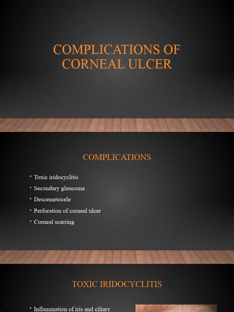Complications Of Untreated Corneal Ulcers
