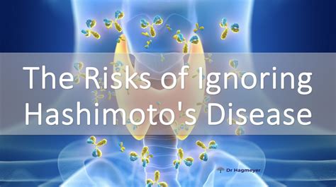 Complications of Untreated Hashimoto's