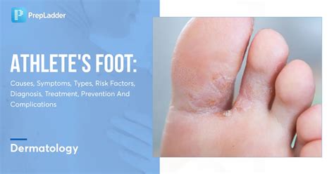 Complications of Athlete's Foot