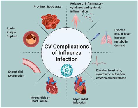 Complications of Influenza