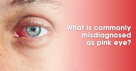 Complications of Pink Eye