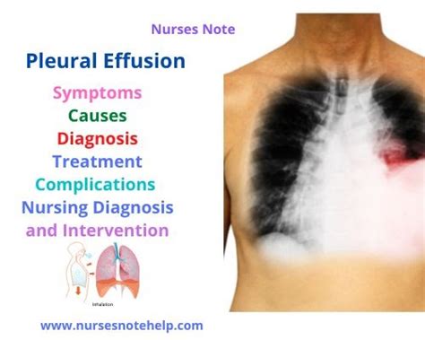 Complications of Pleural Effusion