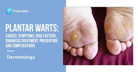 Complications of Warts