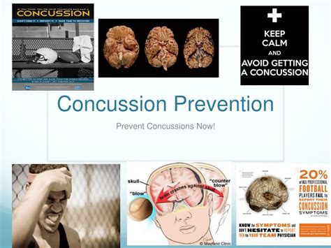 Concussion Prevention Tips