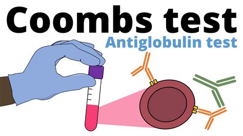 Coombs Antiglobulin Test