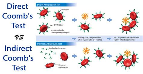 Coombs Test Clinical Applications