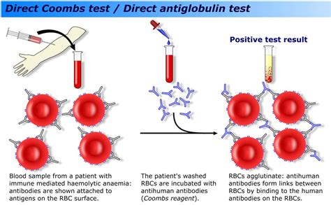 Coombs Test Procedure