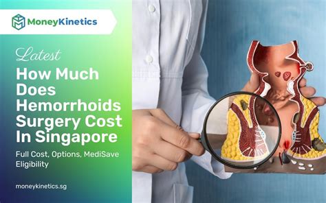 Cost of Hemorrhoid Surgery