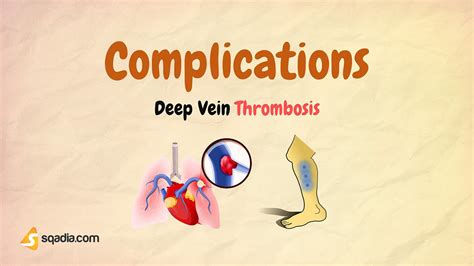 DVT Complications