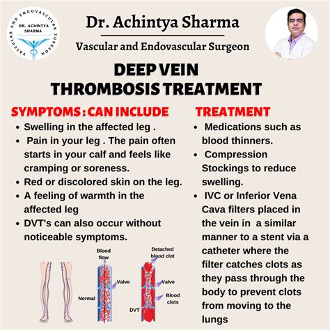 DVT Treatment