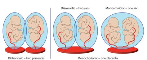Detection of Multiple Pregnancies