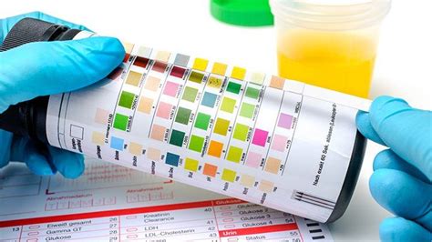 Diagnosing Bladder Infection