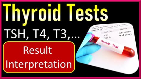 Diagnosing Hypothyroidism with TSH Test