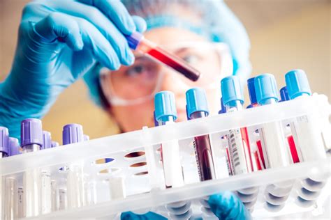 Diagnosis and Testing