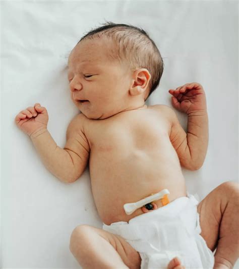 Diagnosis of Belly Button Cord Bleeding Symptoms