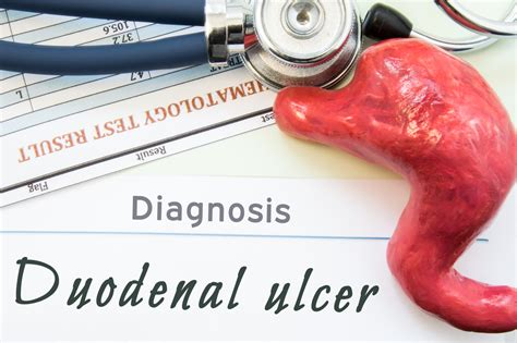 Duodenal Ulcer Healing Process