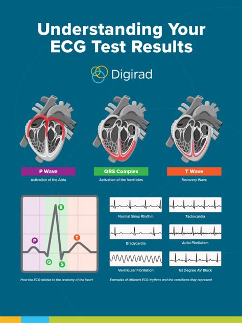 EKG Test Results
