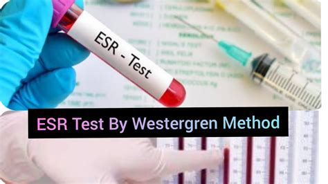 ESR Westergren Method