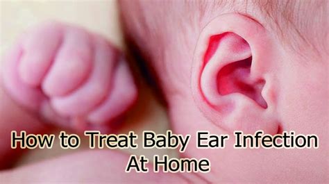 Ear Infection Baby