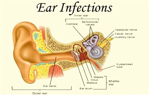 Ear Infection Complications