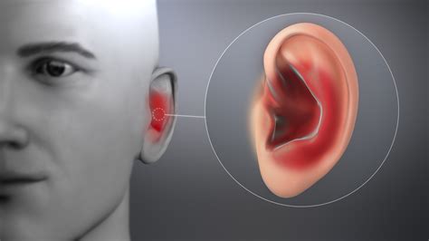Ear and Eye Infections
