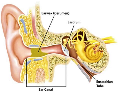 Earwax Impaction Diagnosis