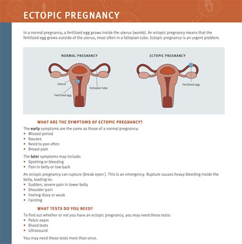 Ectopic Gestation Support