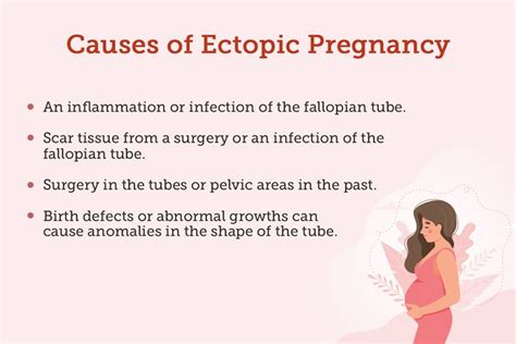 Ectopic Pregnancy Causes