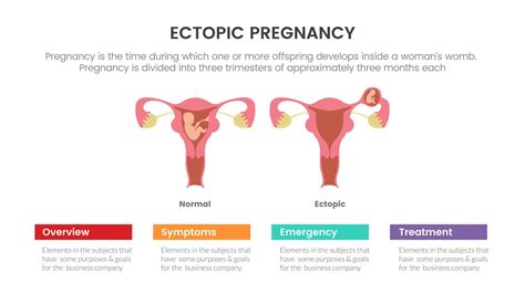 Ectopic Pregnancy Emotional Well-being