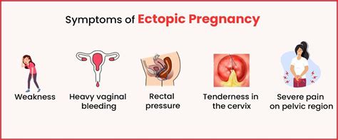 Ectopic Pregnancy Signs