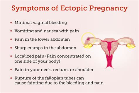 Ectopic Pregnancy Symptoms