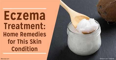 Eczema Treatment
