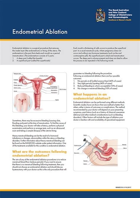 Side Effects of Endometrial Ablation