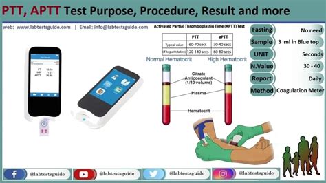 FAQs About 5 PTT Blood Tests