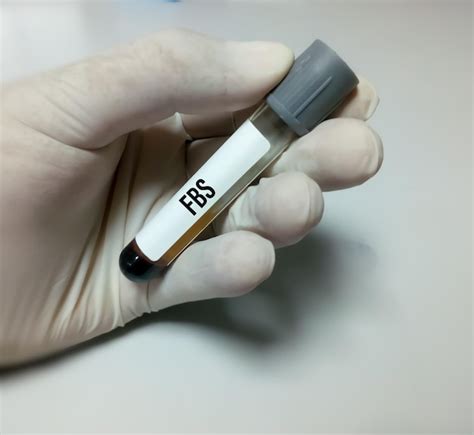 FBS Blood Test Preparation Tips