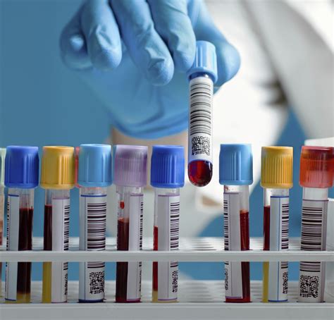 Factors That Influence Blood Test Results