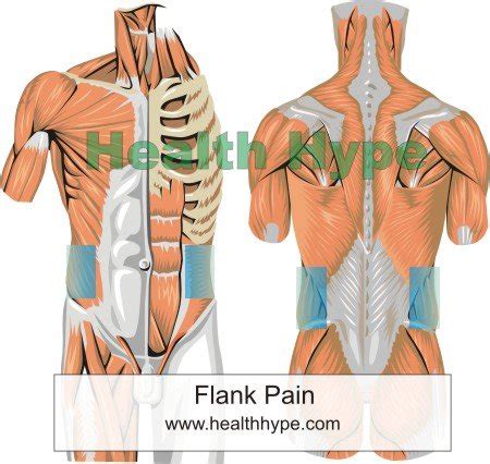 Areas of Flank Pain