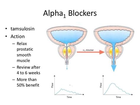 Flomax Management