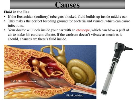 Fluid Buildup In Ear Causes