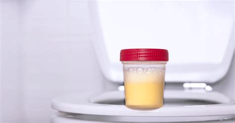 Foamy Urine Risks