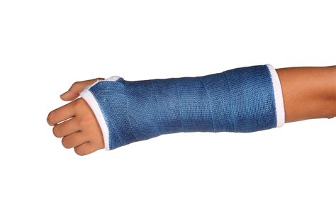 Fractured Arm Cast Care