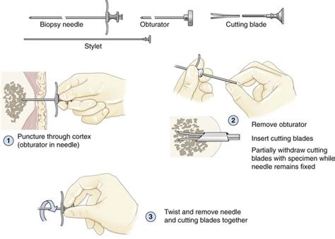 Future Directions in Bone Marrow Examination