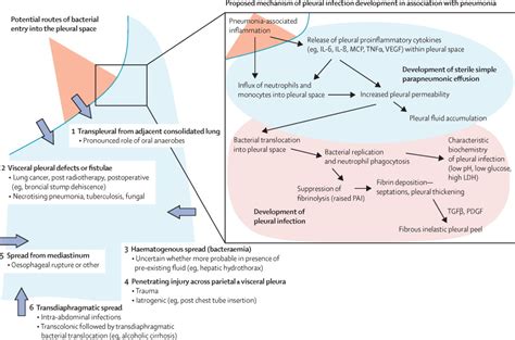 Future Directions in Pleural Effusion