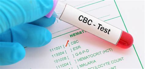 Future of CBC Testing