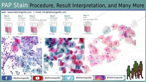 Future of Papanicolaou Test