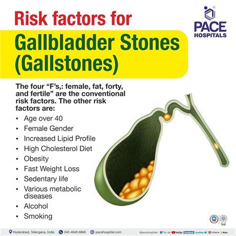 Gallstones and Diet