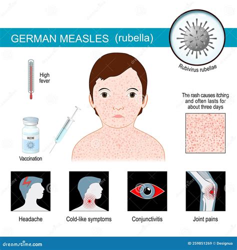 German Measles