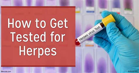 Get Tested For Herpes